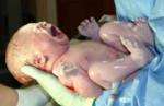 born_alive_infant-240x157